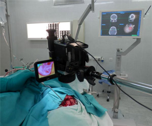 Design of the experiment. Intraoperative thermal imaging when removing brain tumors: recording the original thermal image along with neuronavigation.